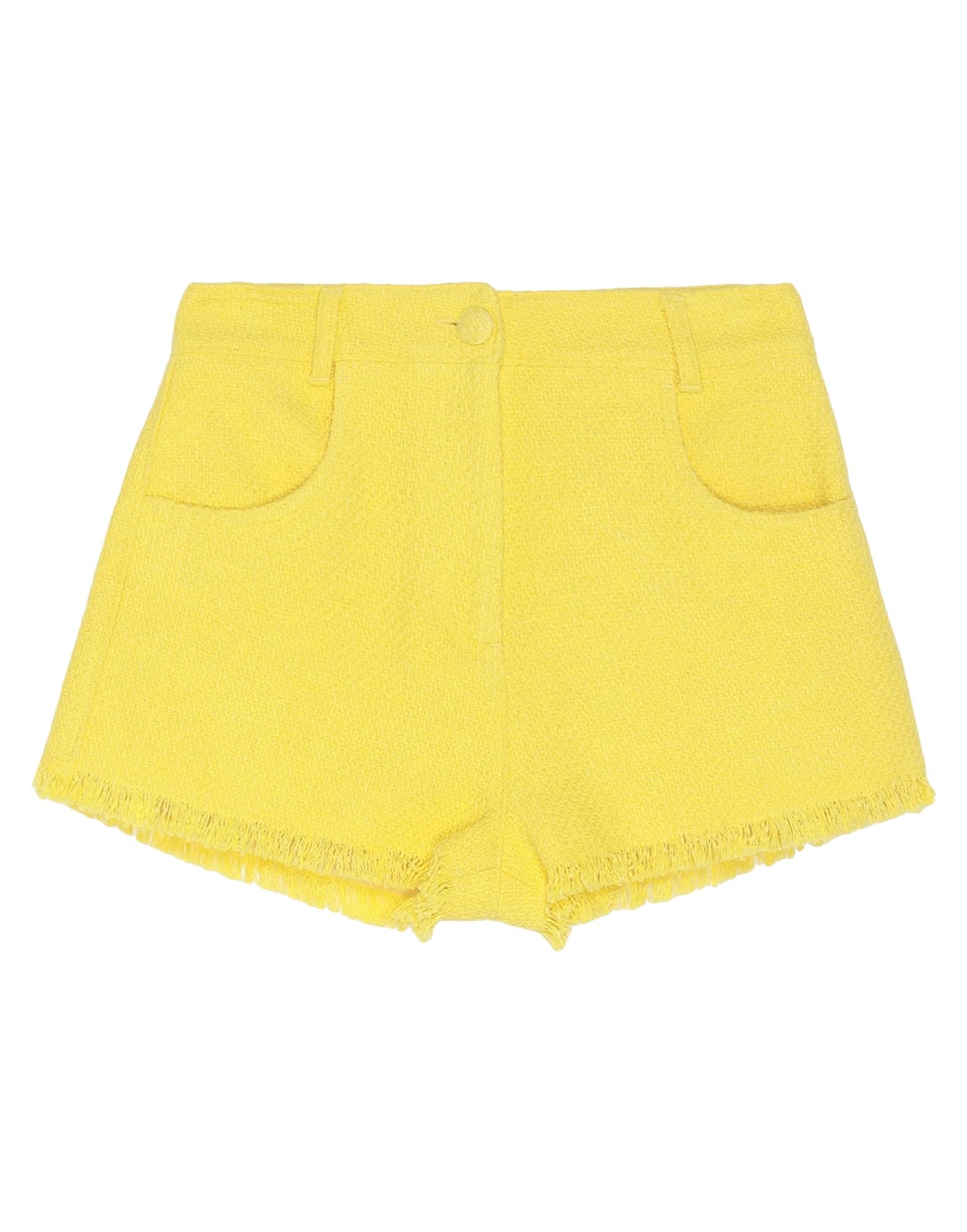 MSGM - Shorts & Bermuda Shorts