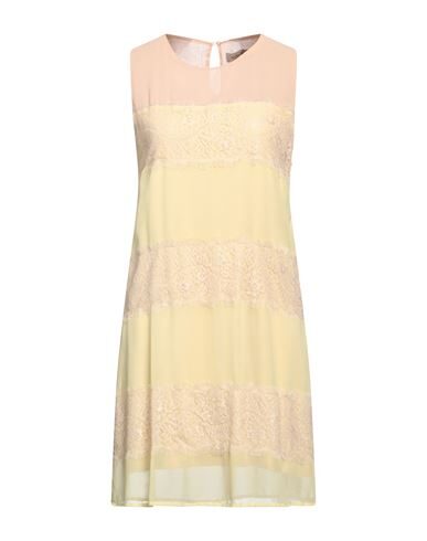 Just For You Short Dresses In Yellow